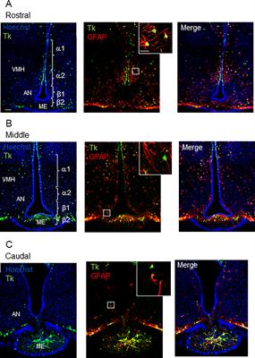 Selective Depletion of Adult GFAP-Expressing Tanycytes Leads to Hypogonadotropic Hypogonadism in Males